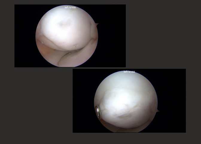 Cartilage Case of the Month - KM