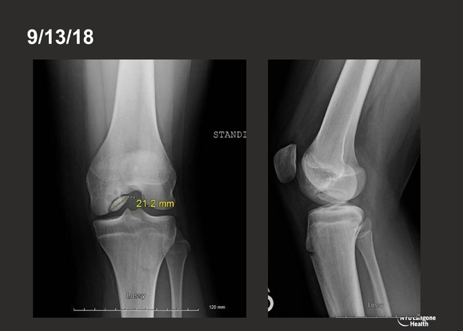 Cartilage Case of the Month - KM